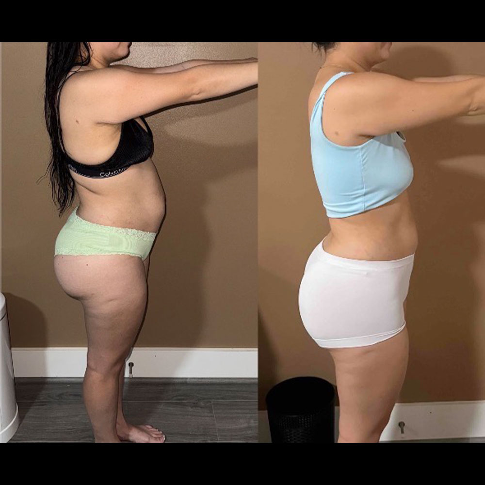 Transformation 3